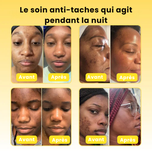 Masque de nuit au curcuma & à l'acide kojique peel off